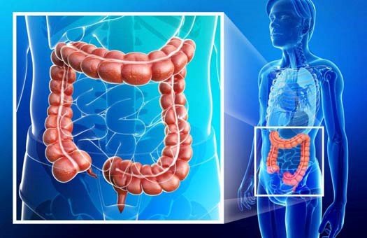 Bowel Detox / Colon Cleanse