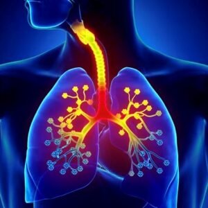 Bronchitis