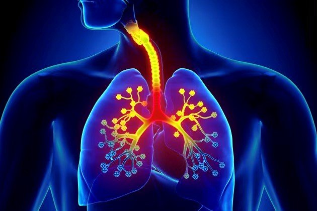 Bronchitis