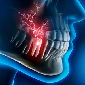 Tooth Ache/ Tooth Decay