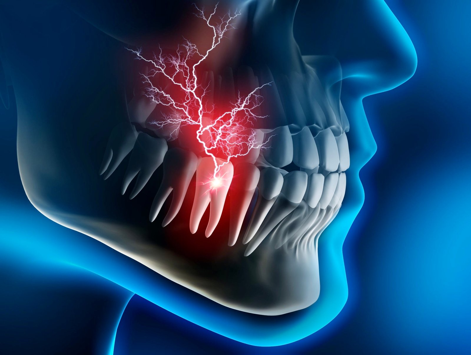 Tooth Ache/ Tooth Decay