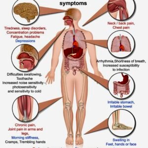 Fibromyalgia