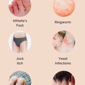 Fungus Infection